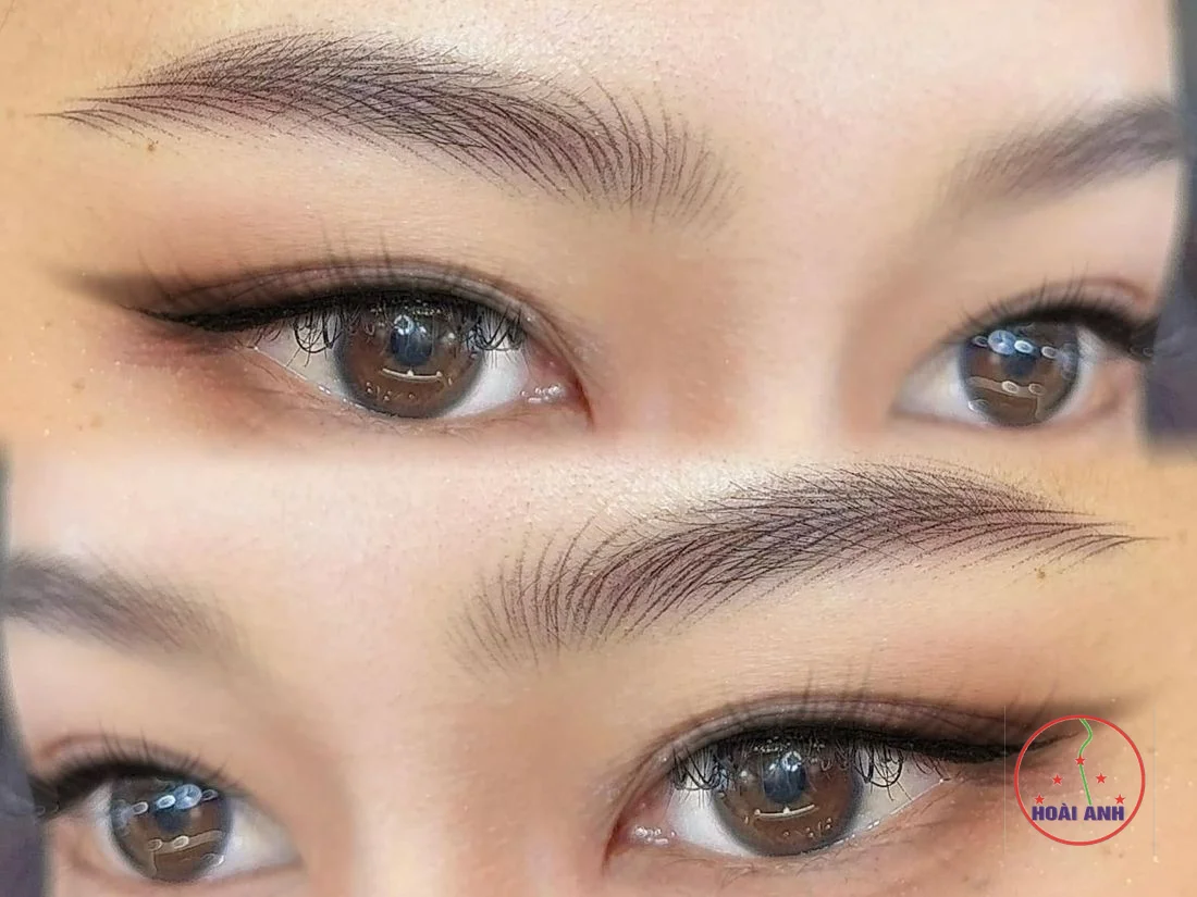 Da mỏng, da nhạy cảm có phun được không?