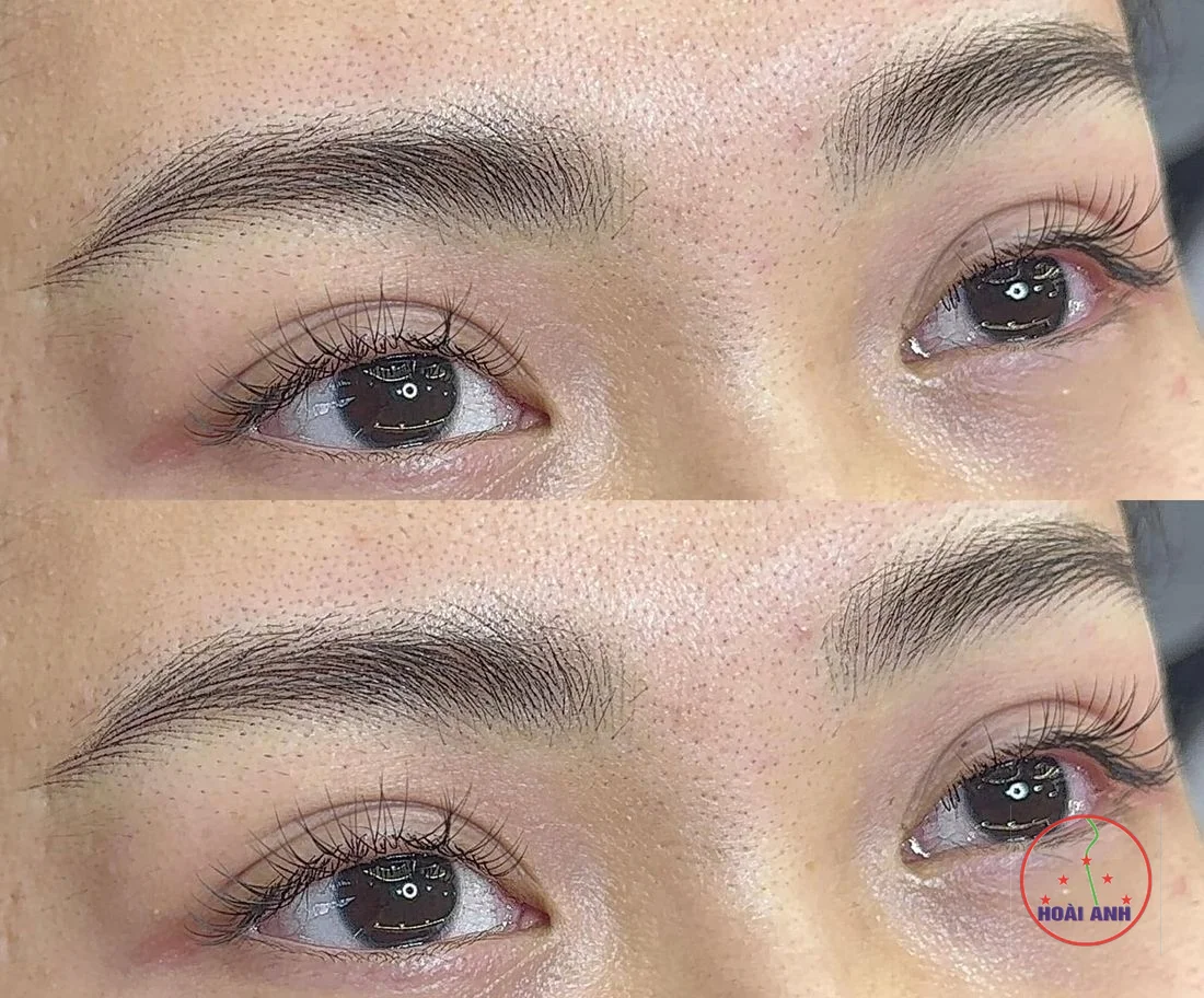 Sửa mày hỏng có đẹp lại không?