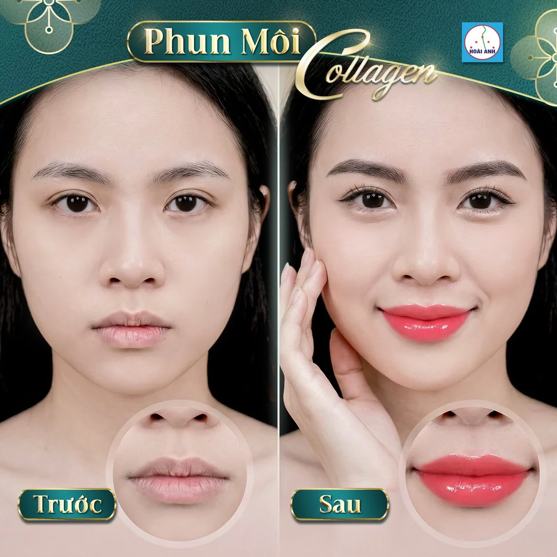 Phun môi cho môi thâm có lên màu không?