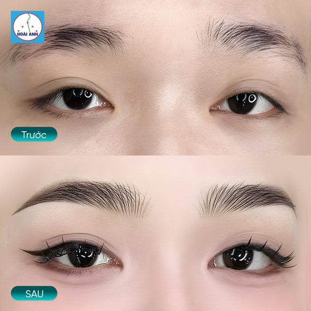 Phun mày Dáng tự nhiên — kết quả tại Hoài Anh