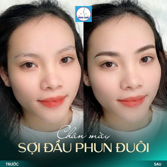 Phun mày Sợi đầu phun đuôi — kết quả tại Hoài Anh