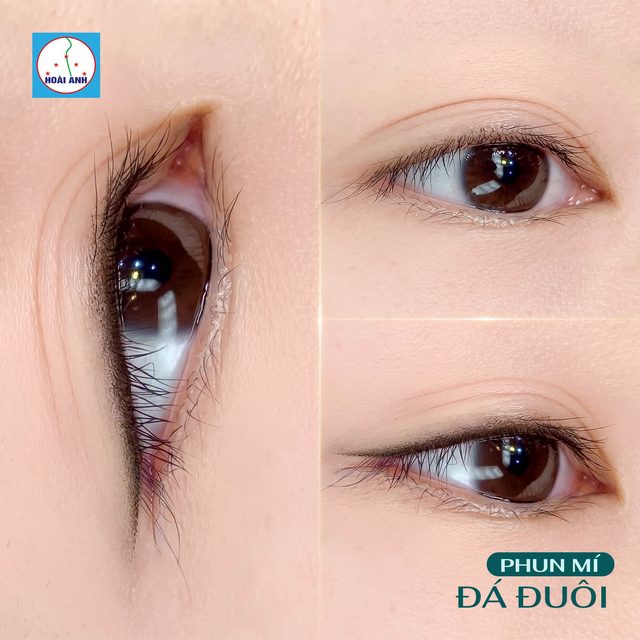 Phun mí Dài đuôi — kết quả tại Hoài Anh