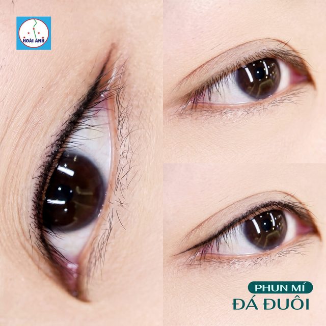 Phun mí Dài đuôi — kết quả tại Hoài Anh