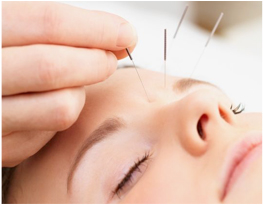 phuong-phap-tri-lieu-doc-dao-an-toan Chi nhánh Quận 1 – TPHCM - Thẩm mỹ viện Hoài Anh